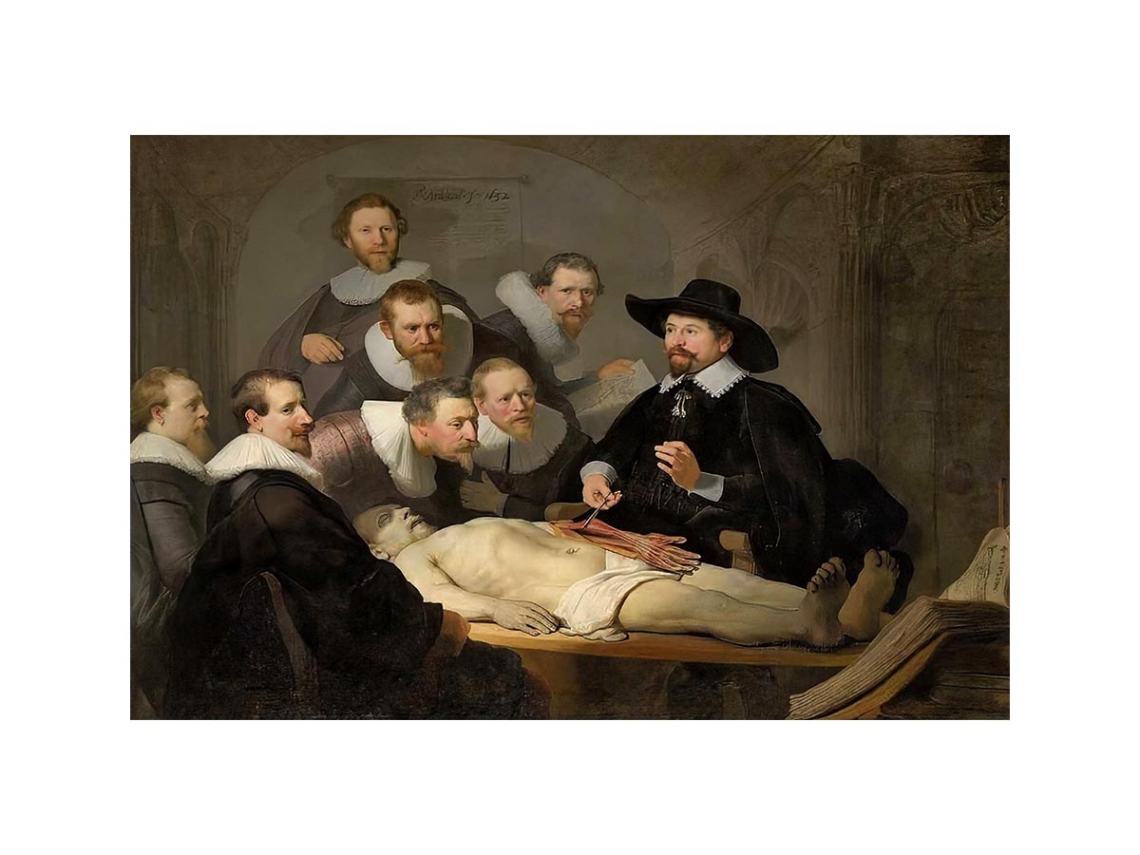 Anatomy Lesson of Dr Tulp