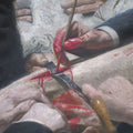 The Gross Clinic (detail) 